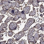 Anti-FLT4 Antibody
