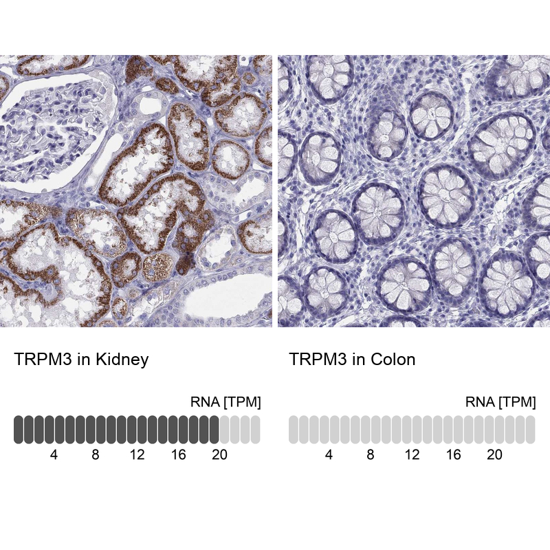 Anti-TRPM3 Antibody