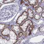 Immunohistochemical staining of human kidney shows high expression.