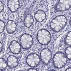 Immunohistochemical staining of human colon shows low expression as expected.