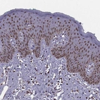 Immunohistochemical staining of human skin shows strong nuclear positivity in squamous epithelial cells.