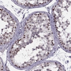Immunohistochemical staining of human testis shows strong nuclear positivity in spermatogonia.