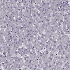 Immunohistochemical staining of human liver shows no positivity in hepatocytes as expected.