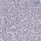 Immunohistochemical staining of human liver shows no positivity in hepatocytes as expected.
