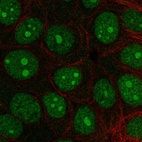 Immunofluorescent staining of human cell line MCF7 shows localization to nucleus & nucleoli.