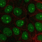 Immunofluorescent staining of human cell line MCF7 shows localization to nucleus & nucleoli.