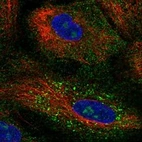 Immunofluorescent staining of human cell line A549 shows localization to nucleoli, cytosol & vesicles.