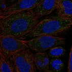 Anti-CYP2C18 Antibody