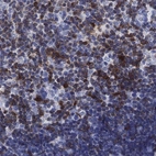Anti-SH2D2A Antibody