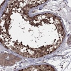 Anti-NAA50 Antibody