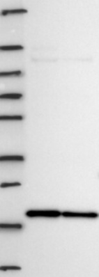 Lane 1: Marker [kDa] 250, 130, 95, 72, 55, 36, 28, 17, 10 | Lane 2: RT4 | Lane 3: U-251 MG