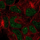 Anti-GON4L Antibody