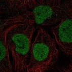 Anti-MYCL Antibody