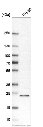 Anti-RAB8B Antibody