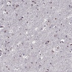 Immunohistochemical staining of human cerebral cortex shows high expression.