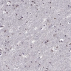 Immunohistochemical staining of human cerebral cortex shows high expression.
