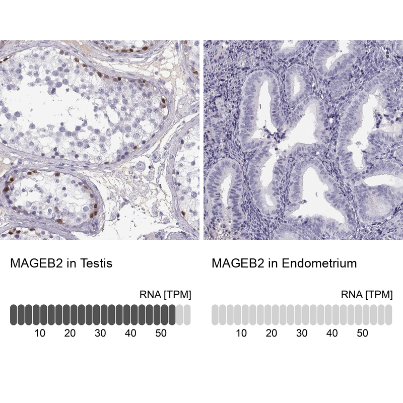 Anti-MAGEB2 Antibody