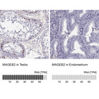 Anti-MAGEB2 Antibody