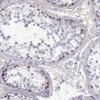 Immunohistochemical staining of human testis shows high expression.