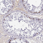 Immunohistochemical staining of human testis shows strong nuclear positivity in spermatogonia.