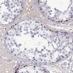 Immunohistochemical staining of human testis shows strong nuclear positivity in spermatogonia.