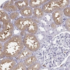 Immunohistochemical staining of human kidney shows moderate cytoplasmic positivity in cells in tubules.