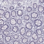 Immunohistochemical staining of human small intestine shows no positivity in glandular cells as expected.