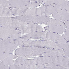 Anti-SLC22A6 Antibody