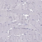 Immunohistochemical staining of human skeletal muscle shows no positivity in myocytes as expected.