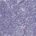 Anti-SLC22A6 Antibody