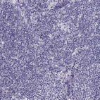 Immunohistochemical staining of human lymph node shows no positivity in non-germinal center cells as expected.