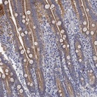 Anti-RGS1 Antibody