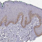 Anti-TACR1 Antibody