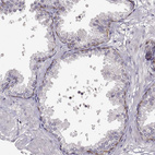 Immunohistochemical staining of human prostate shows moderate membranous positivity in basal cells.