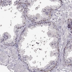 Immunohistochemical staining of human prostate shows moderate membranous positivity in basal cells.