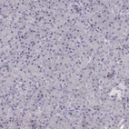 Immunohistochemical staining of human pancreas shows no positivity in exocrine glandular cells as expected.