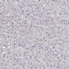 Anti-TACR1 Antibody