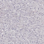 Immunohistochemical staining of human liver shows no positivity in hepatocytes as expected.