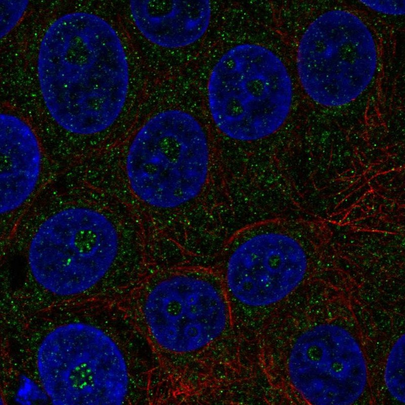 Anti-TMEM217 Antibody