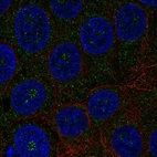 Anti-TMEM217 Antibody