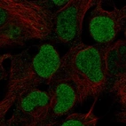 Anti-BRD2 Antibody