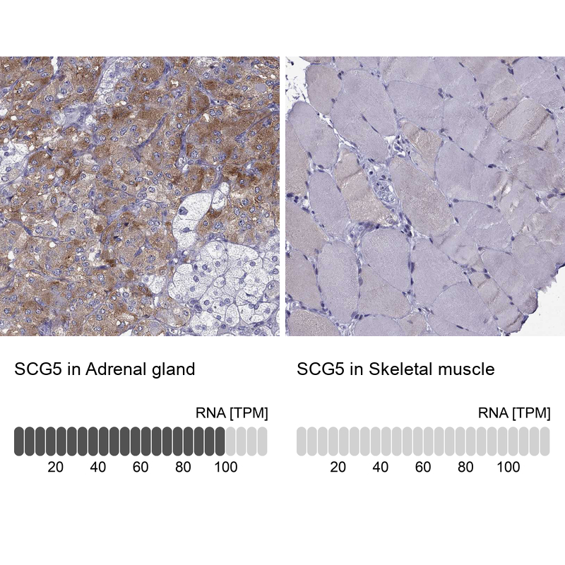 Anti-SCG5 Antibody