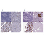 Immunohistochemical staining of human lymphoid tissues, pancreas, pituitary gland and skeletal muscle using Anti-SCG5 antibody HPA074618 (A) shows similar protein distribution across tissues to independent antibody HPA013136 (B).