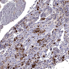 Immunohistochemical staining of human pituitary gland shows strong cytoplasmic positivity in endocrine glandular cells.