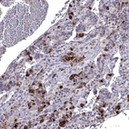 Immunohistochemical staining of human pituitary gland shows strong cytoplasmic positivity in endocrine glandular cells.