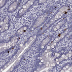 Immunohistochemical staining of human duodenum shows strong cytoplasmic positivity in enteroendocrine cells.