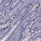 Immunohistochemical staining of human duodenum shows strong cytoplasmic positivity in enteroendocrine cells.