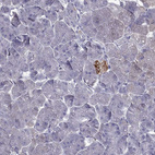 Immunohistochemical staining of human pancreas shows moderate cytoplasmic positivity in islets of Langerhans.