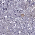 Immunohistochemical staining of human pancreas shows moderate cytoplasmic positivity in islets of Langerhans.