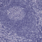 Immunohistochemical staining of human lymph node shows no cytoplasmic positivity in germinal center cells and non-germinal center cells.